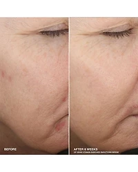 Boost Your Base Vitamin Enriched Moisturizer & Serum Set ($154 value)