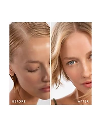 Scalp Remedy Shampoo 8 oz.
