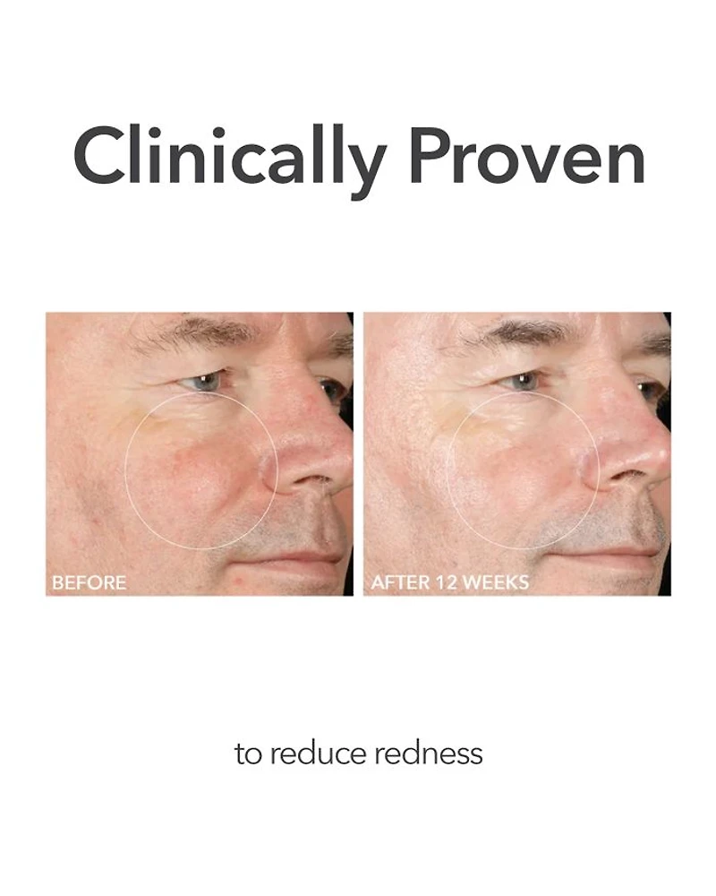Alpha Beta® Extra Strength Daily Peel