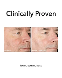 Alpha Beta® Extra Strength Daily Peel