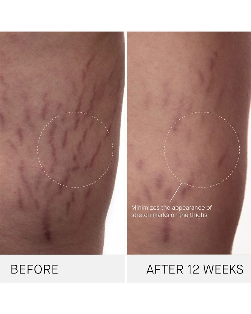 The Body Cream