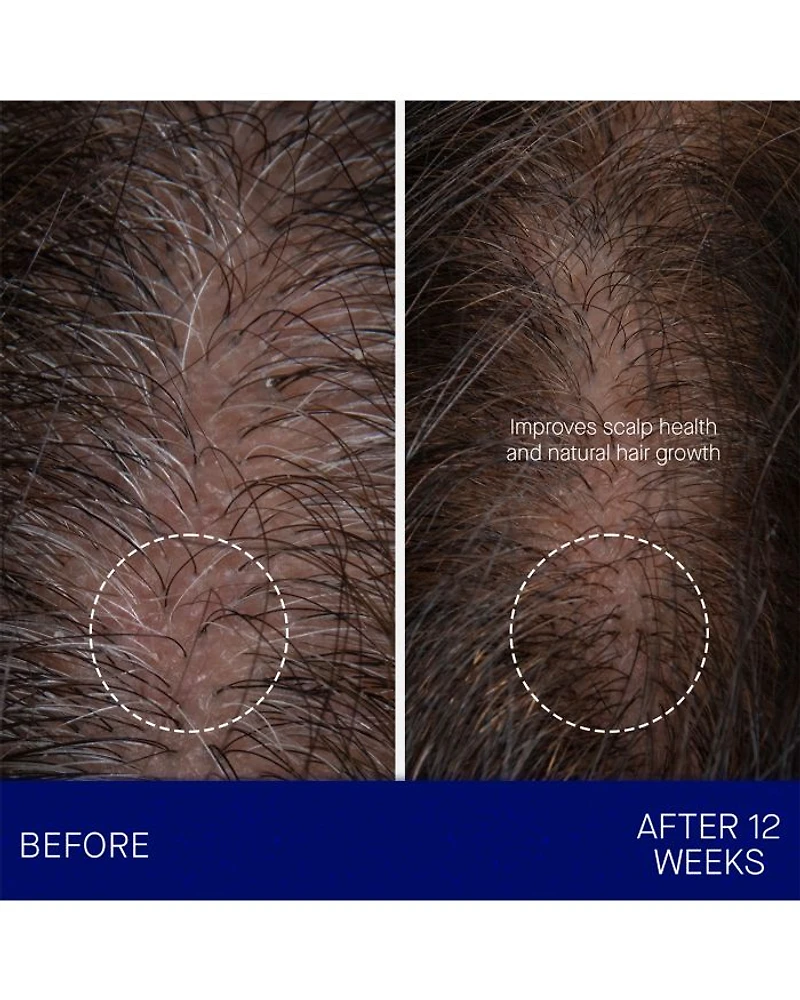 The Scalp Treatment 1 oz.