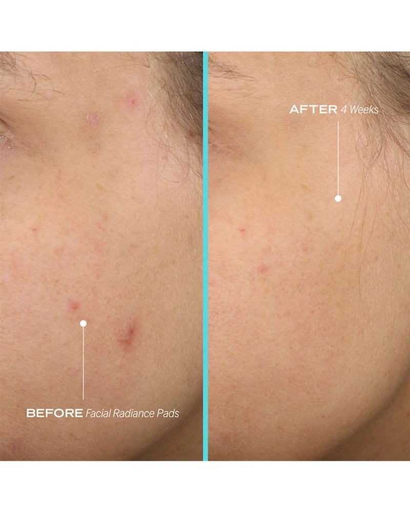 Facial Radiance Pads with Glycolic & Lactic Acids Exfoliating AHA