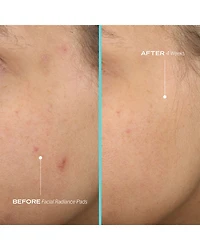 Facial Radiance Pads with Glycolic & Lactic Acids Exfoliating AHA