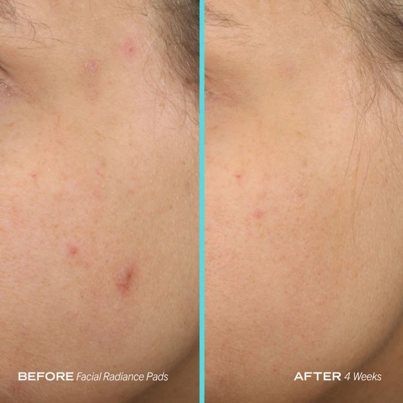 Facial Radiance Pads with Glycolic & Lactic Acids Exfoliating AHA