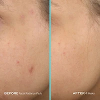 Facial Radiance Pads with Glycolic & Lactic Acids Exfoliating AHA