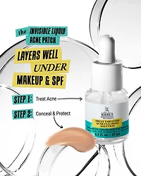 Truly Targeted Acne Clearing Solution with Salicylic Acid 0.5 oz.