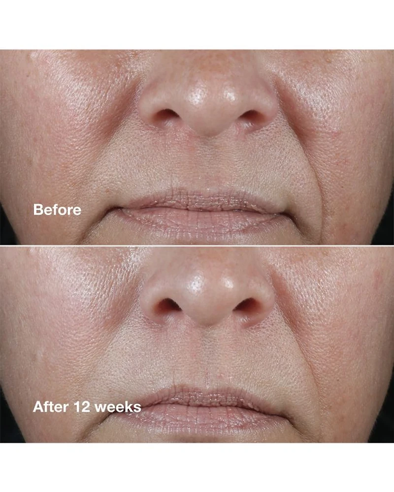 Smart Clinical Repair Wrinkle Correcting Rich Cream 1.7 oz.