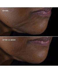 Smart Clinical Repair Lifting Face + Neck Cream