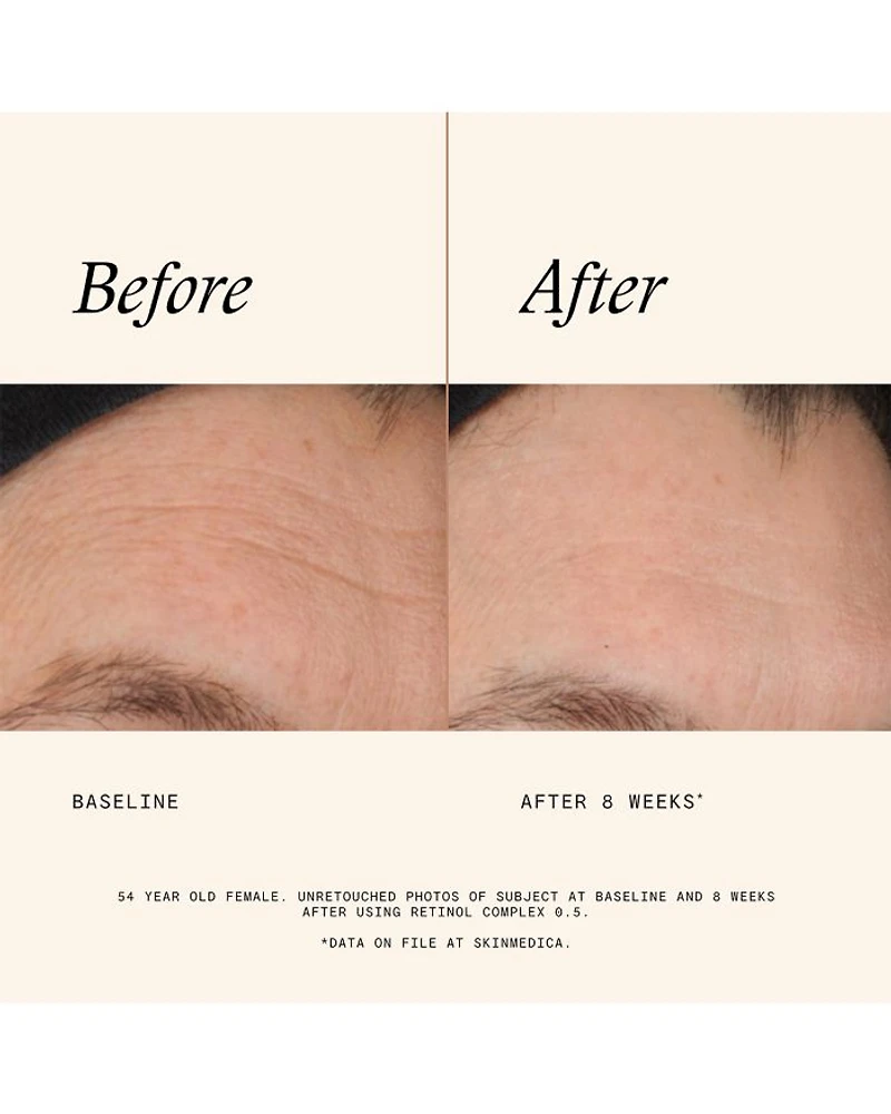 Retinol Complex 0.5 1 oz.