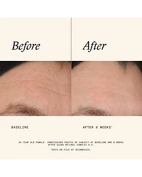 Retinol Complex 0.5 1 oz.