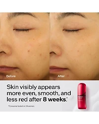 Ultimune Power Infusing Serum