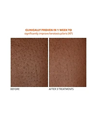 Alpha Beta® Exfoliating Body Treatment