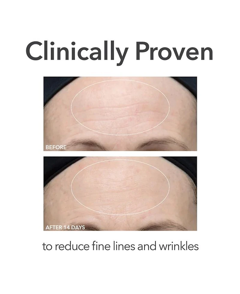 Alpha Beta Ultra Gentle Daily Peel, 30 Treatments