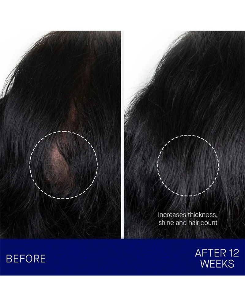 The Scalp Treatment 1 oz.