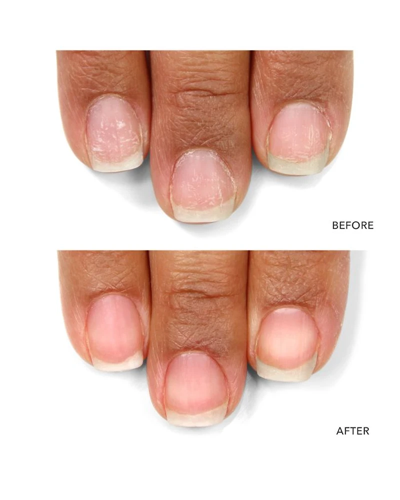 Nail Probiotic Instant Boost 0.4 oz.