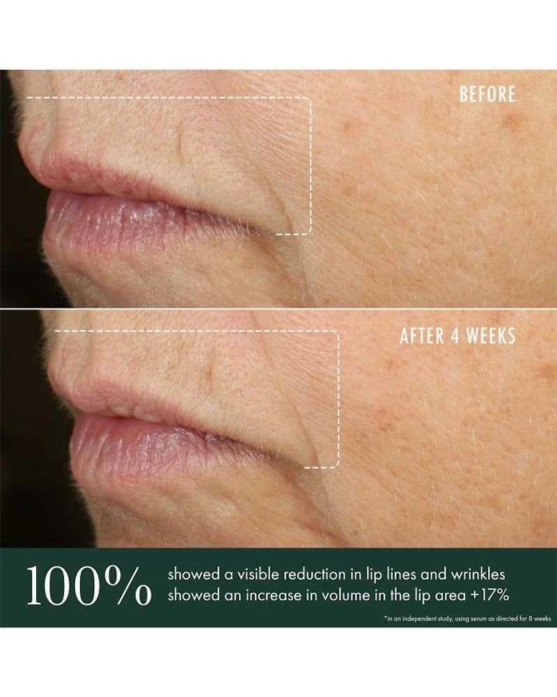 Advanced Lip Perioral Serum Targeted Vertical Line Filler 0.5 oz.