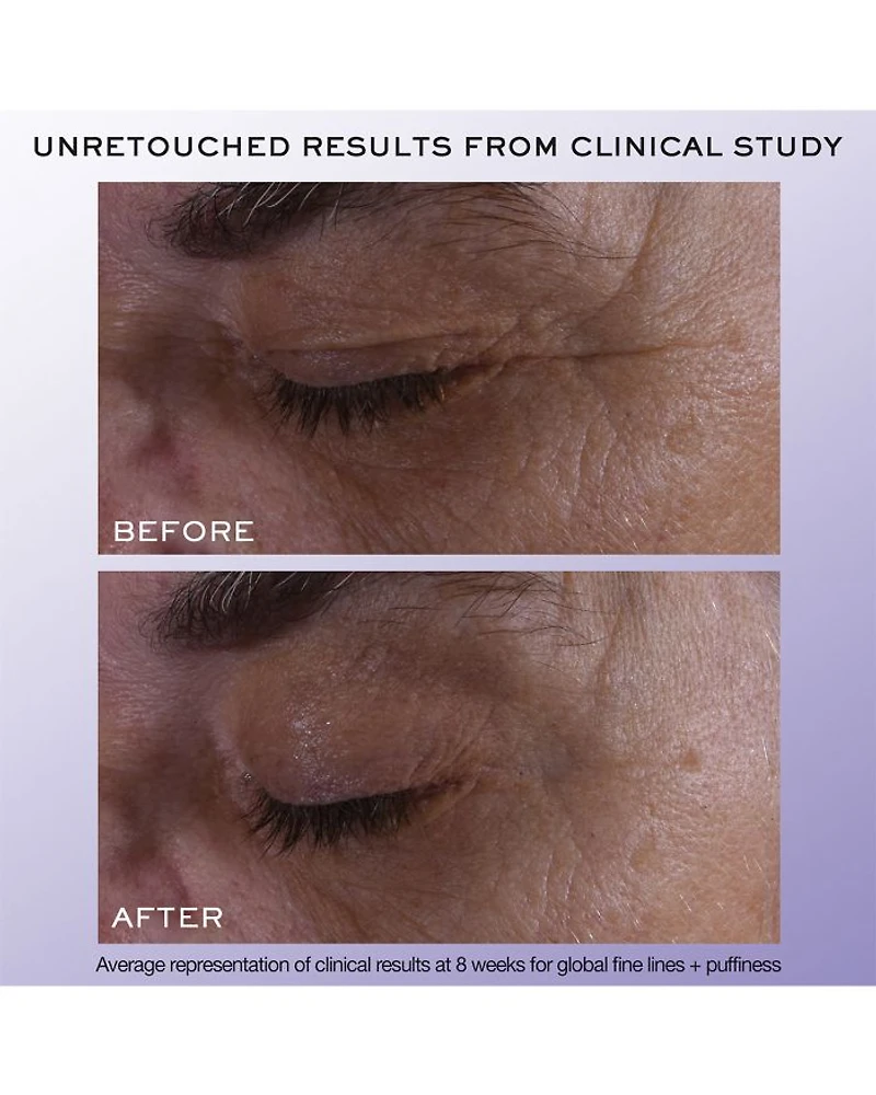 Rénergie H.C.F. Triple Serum Eye 0.67 oz.
