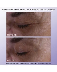 Rénergie H.C.F. Triple Serum Eye 0.67 oz.