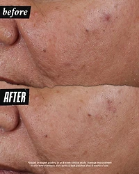Auto Tone Discoloration & UV Solution 1.4 oz.