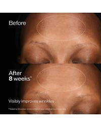 Future Solution LX Total Regenerating Cream