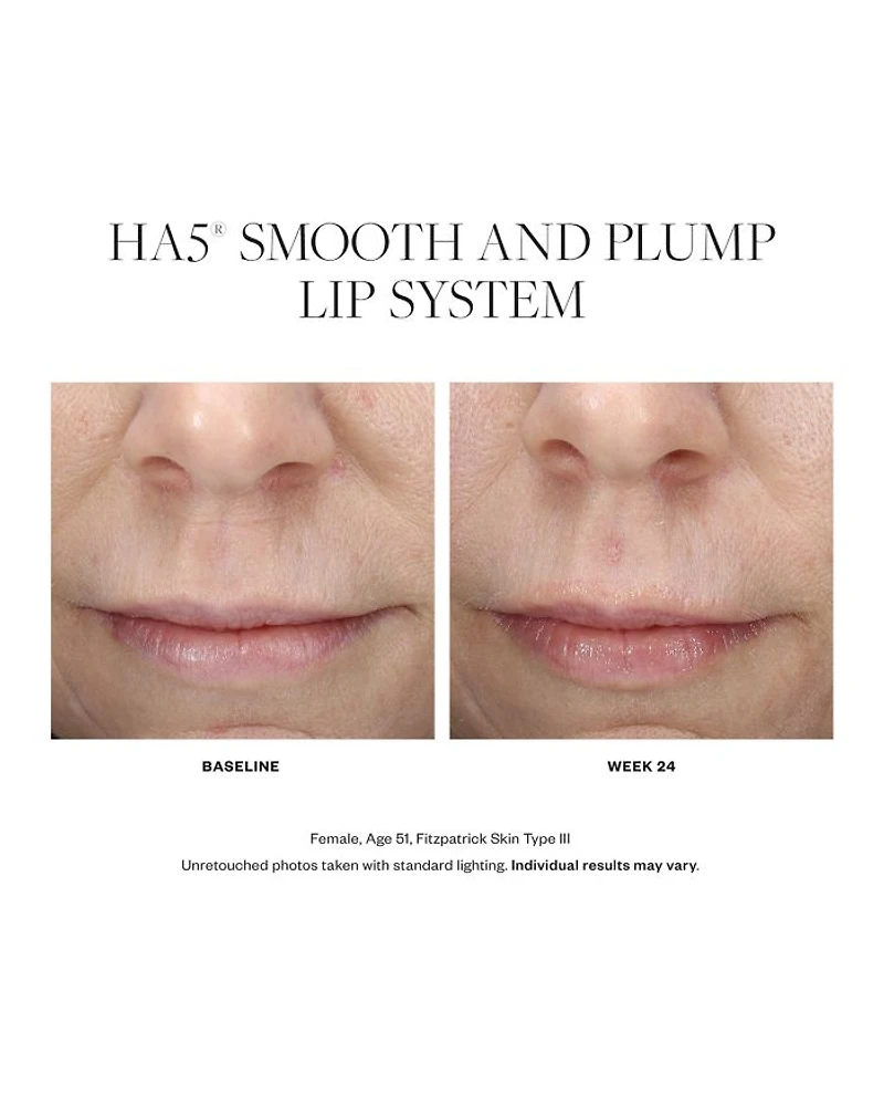 HA5 Smooth & Plump Lip System