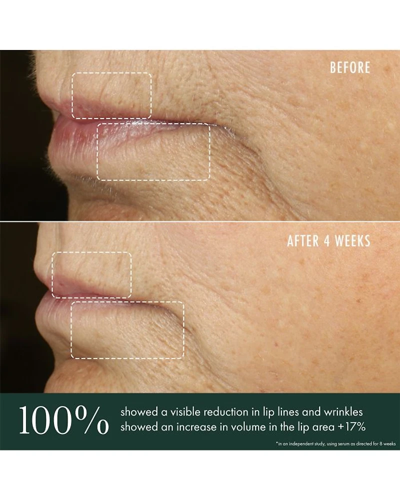 Advanced Lip Perioral Serum Targeted Vertical Line Filler 0.5 oz.