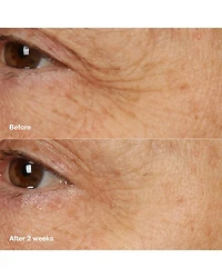 Smart Clinical Repair Overnight Recovery Cream + Mask 1.7 oz.
