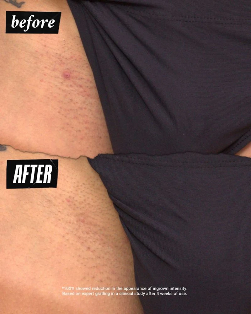 Ingrown Hair & Tone Correcting Intimate Drops 1 oz.