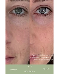 Retin C Treatment Complex 1 oz.
