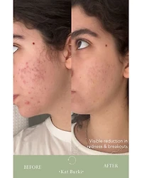 Vitabiome Active Skin Optimizer 3.4 oz.