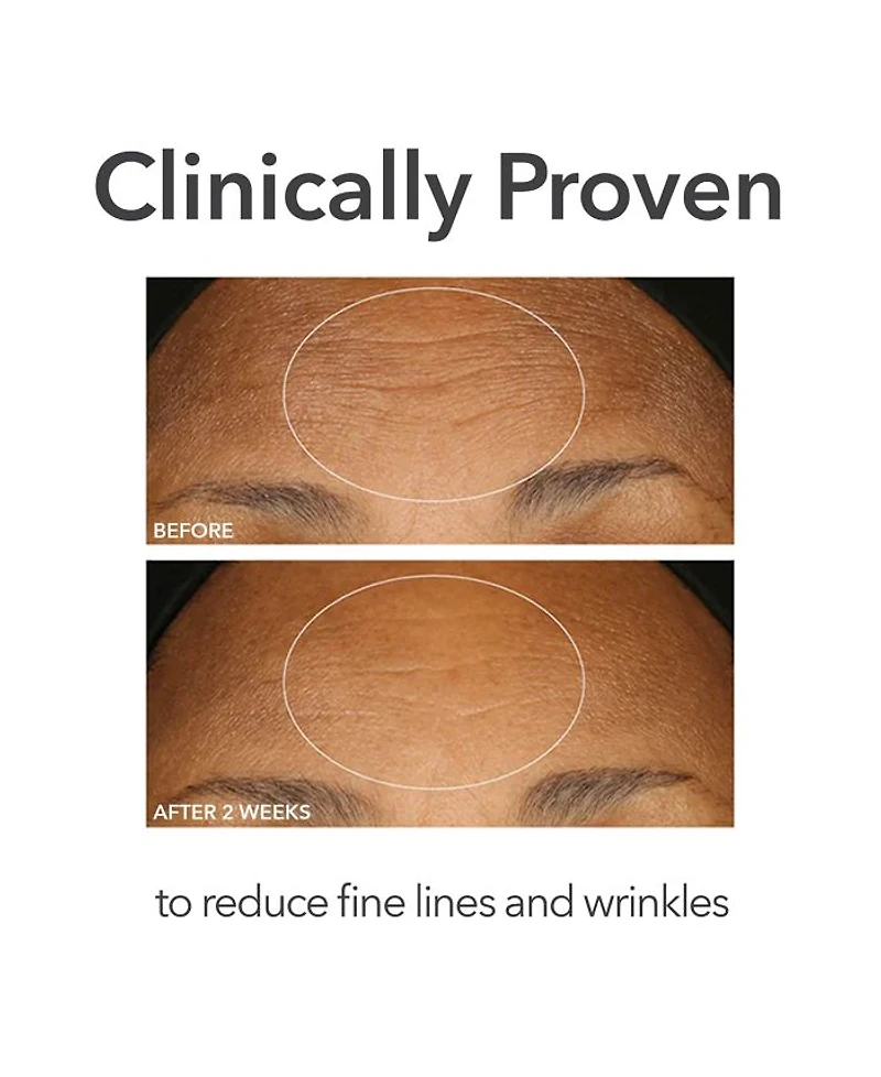 Alpha Beta® Extra Strength Daily Peel
