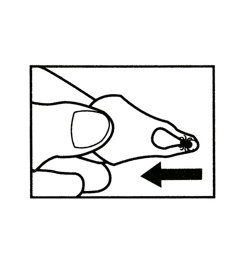 Set of 3 Tick Key Tick Removers