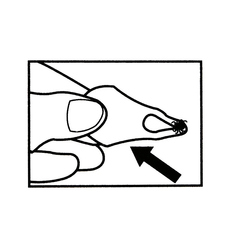 Set of 3 Tick Key Tick Removers