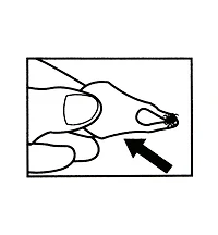 Set of 3 Tick Key Tick Removers