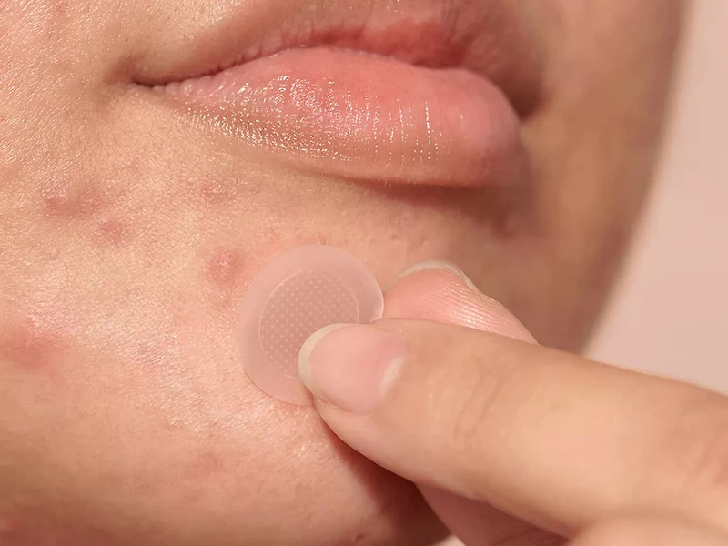 Mighty Patch™ Micropoint for Blemishes - 8 Pack