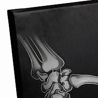 Personalized Skeleton Heart Hands Canvas Art Print