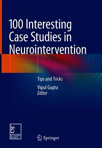 100 Interesting Case Studies in Neurointervention : Tips and Tricks