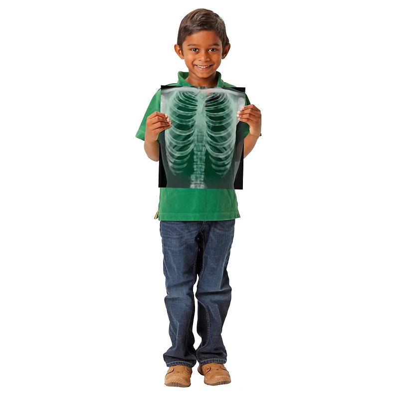 Roylco® True to Life Human X-Ray Set, Pack of 18