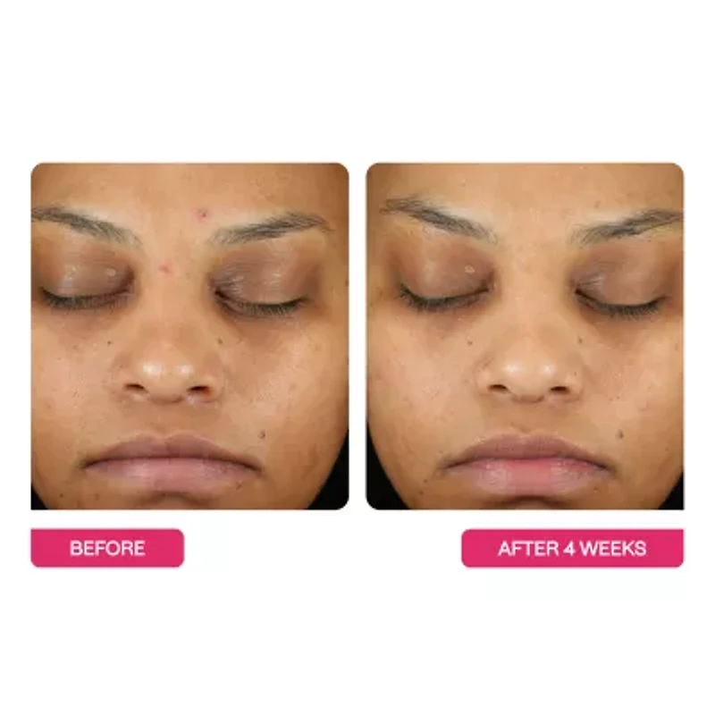 BeautyStat Universal Triple Action Peel Pads 10 Pack