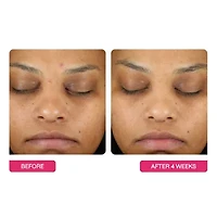 BeautyStat Universal Triple Action Peel Pads 10 Pack