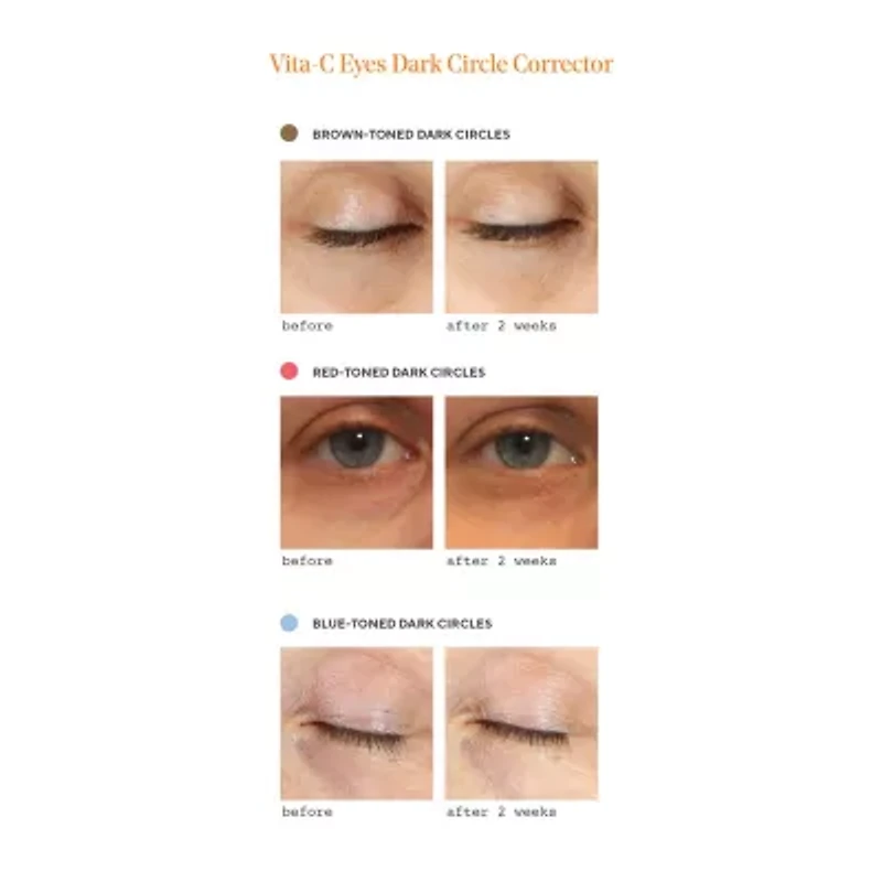Murad Vita C Dark Circle Corrector Eye Cream
