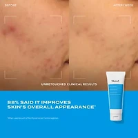 Murad Acne Control Clarifying Cleanser