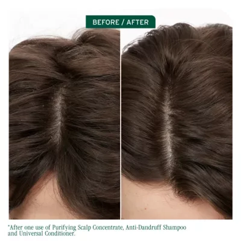 Biolage Scalp Sync Anit-Dandruff Shampoo 13.5 oz.