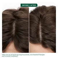 Biolage Scalp Sync Anit-Dandruff Shampoo 13.5 oz.