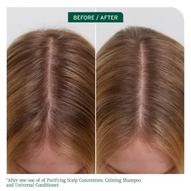 Biolage Scalp Sync Purifying Concentrate Scalp Treatment 6.8 oz.