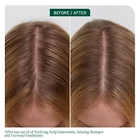 Biolage Scalp Sync Purifying Concentrate Scalp Treatment 6.8 oz.