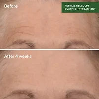 Murad Retinal Resculpting Overnight Facial Treatment