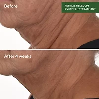 Murad Retinal Resculpting Overnight Treatment Facial Treatment
