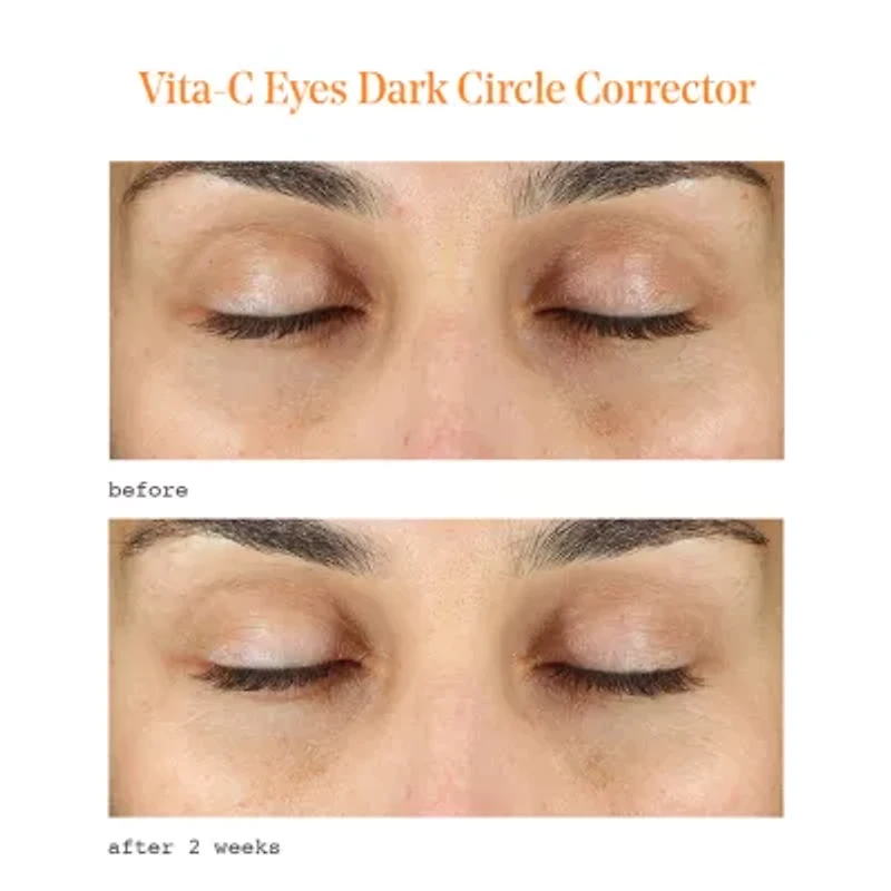 Murad Vita C Dark Circle Corrector Eye Cream
